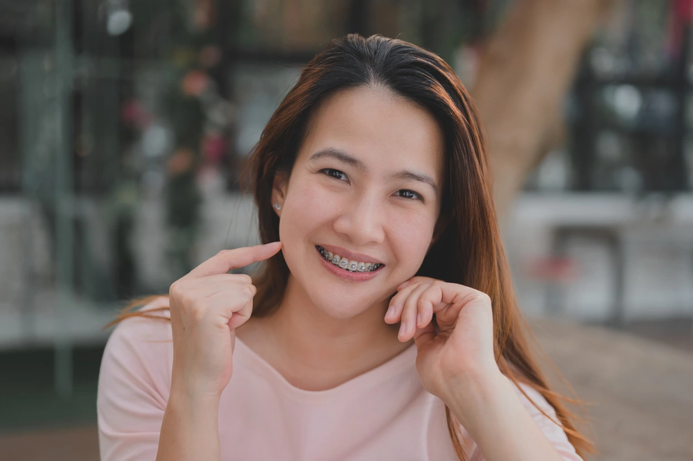 a woman representing an adult with braces