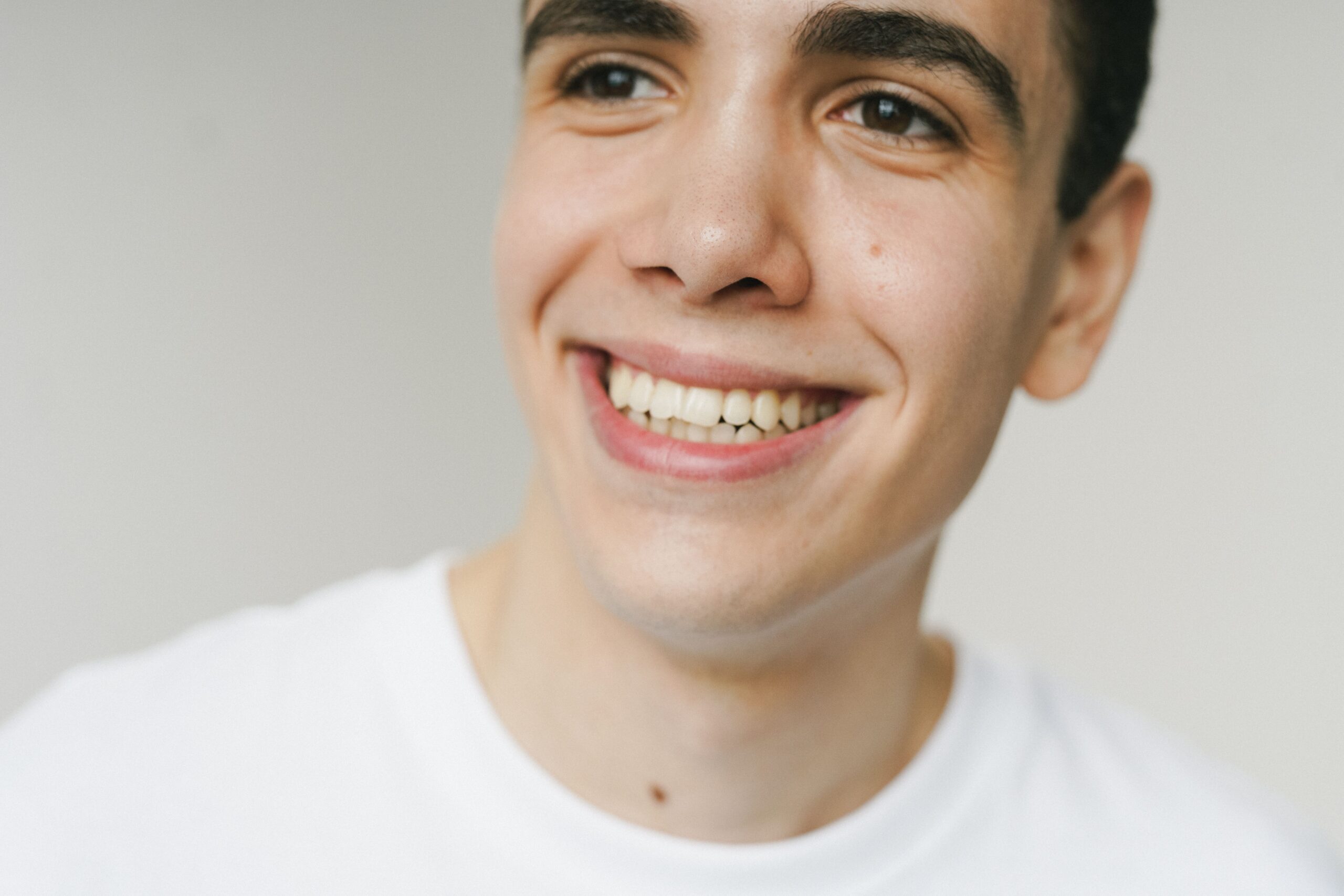 Adult male with slight overbite and chipped front tooth